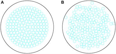 Spatiotemporal Dynamics of Insulitis in Human Type 1 Diabetes